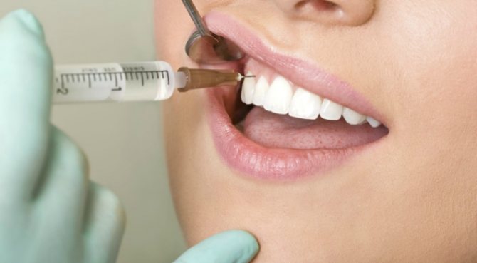 Dental Injection