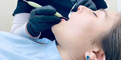 Tooth Preparation