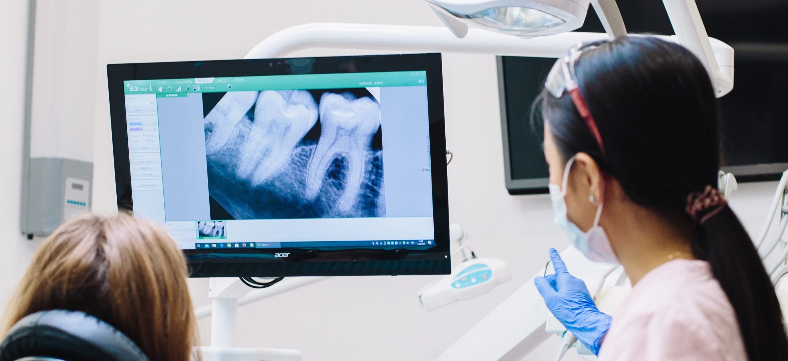 Tooth Extraction Melbourne