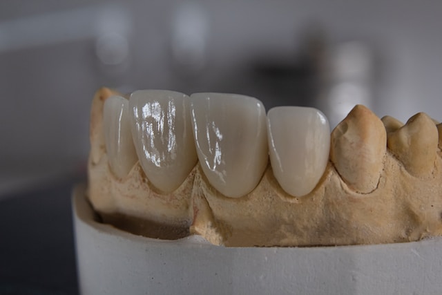 Do Veneers Hurt?
