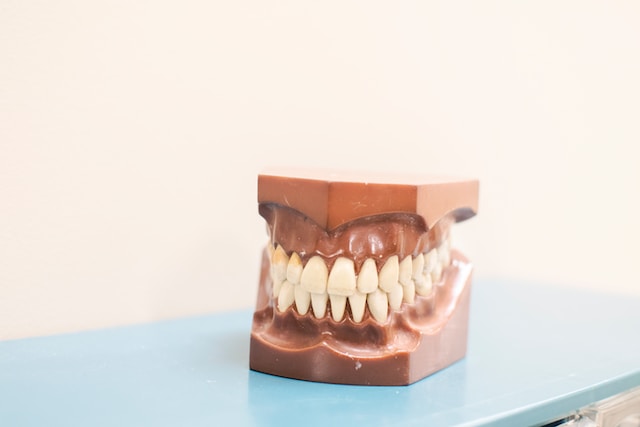 Veneers for Your Lifestyle
