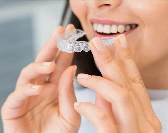 Invisalign Lite vs Moderate vs Full – Which Do I Need?