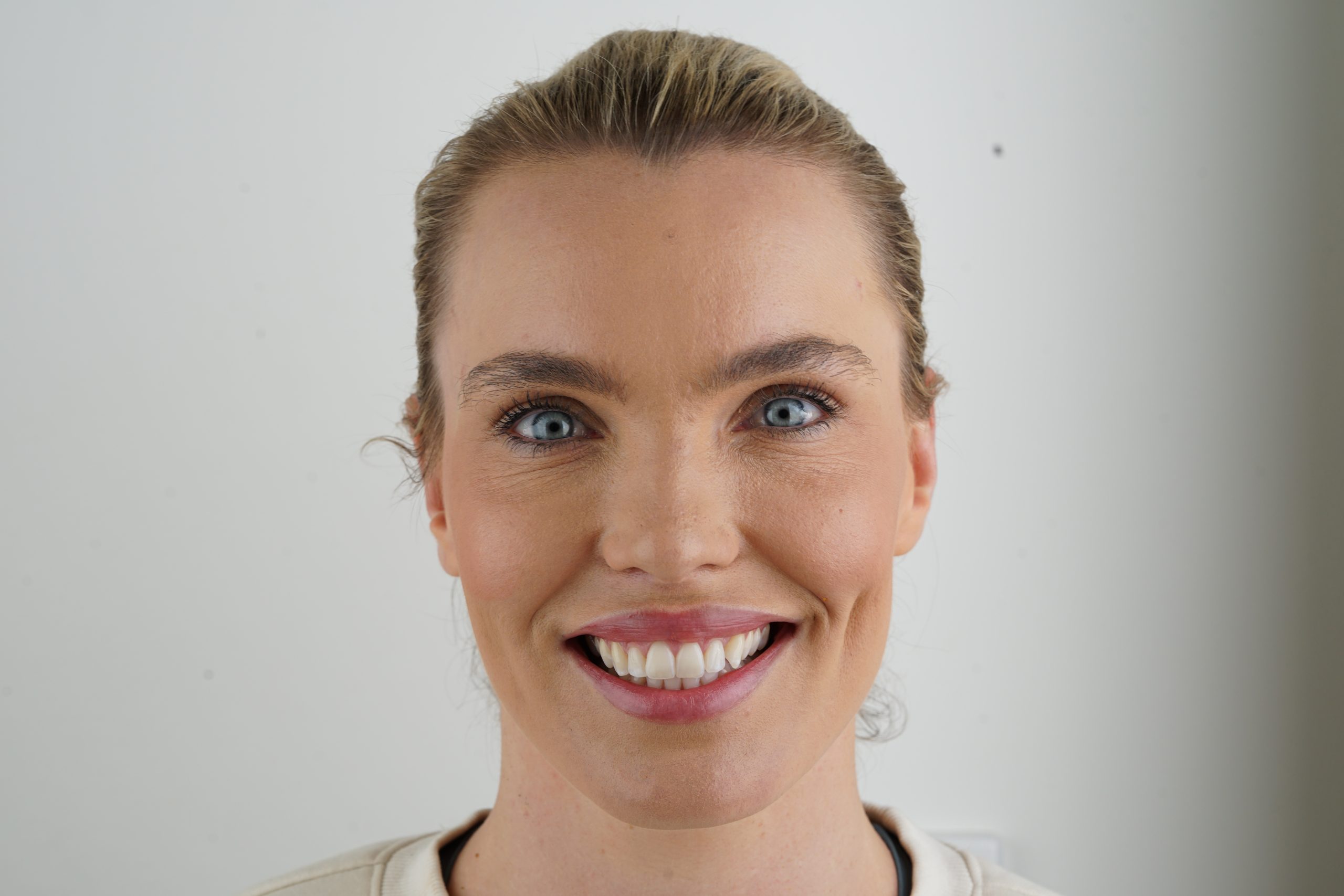How Much Does Invisalign Cost in Melbourne?