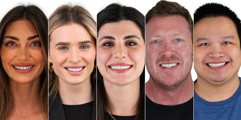 Veneers Melbourne CBD